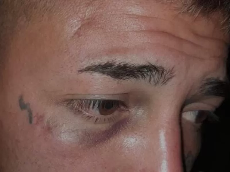 Un joven fue brutalmente golpeado y amenazado por su ex pareja